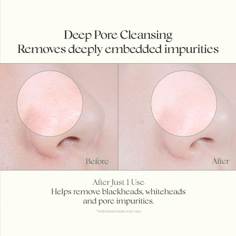 heartleaf vegan pore cleansing oil